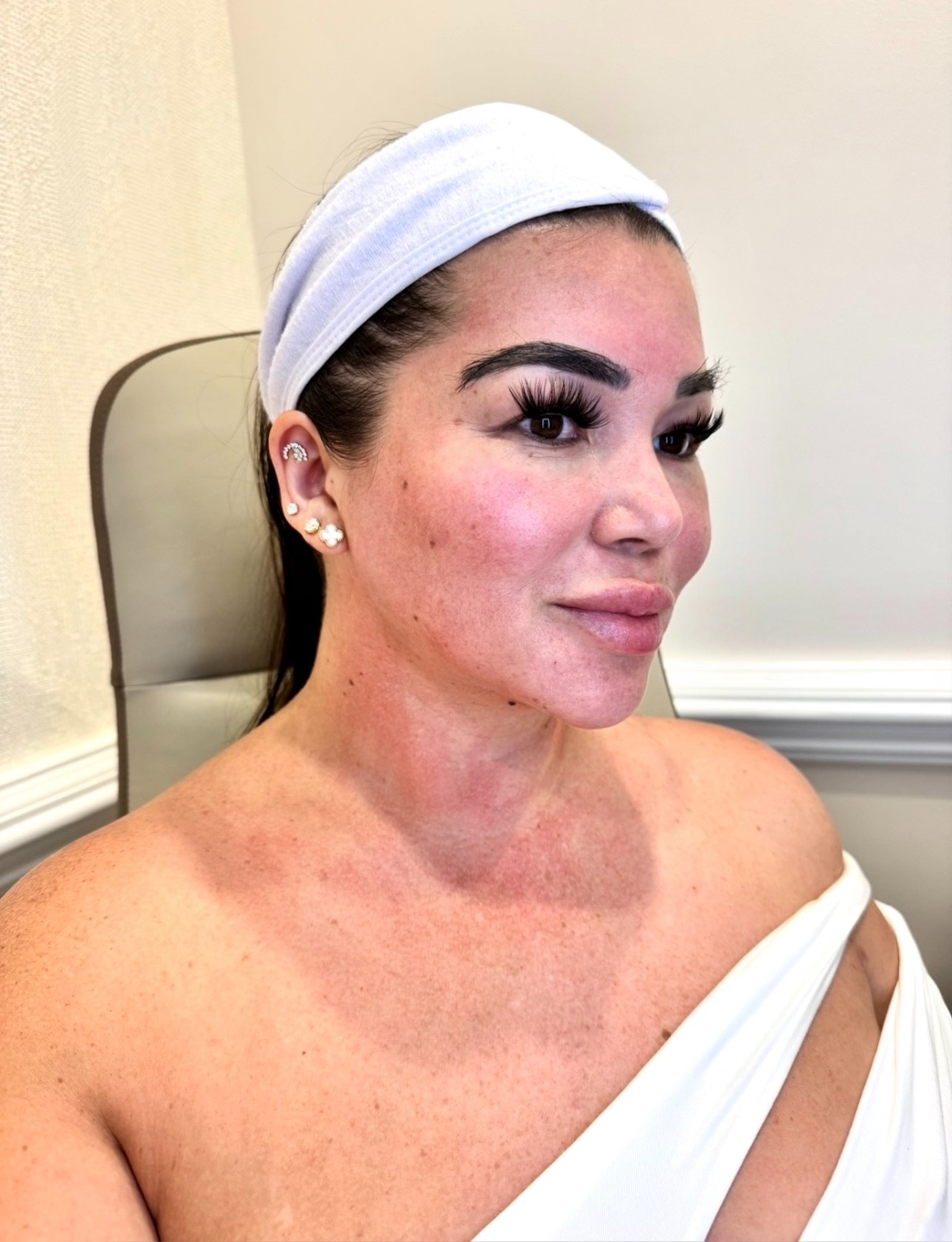 Microneedling, Explained: What Is Your Skin Actually Doing?