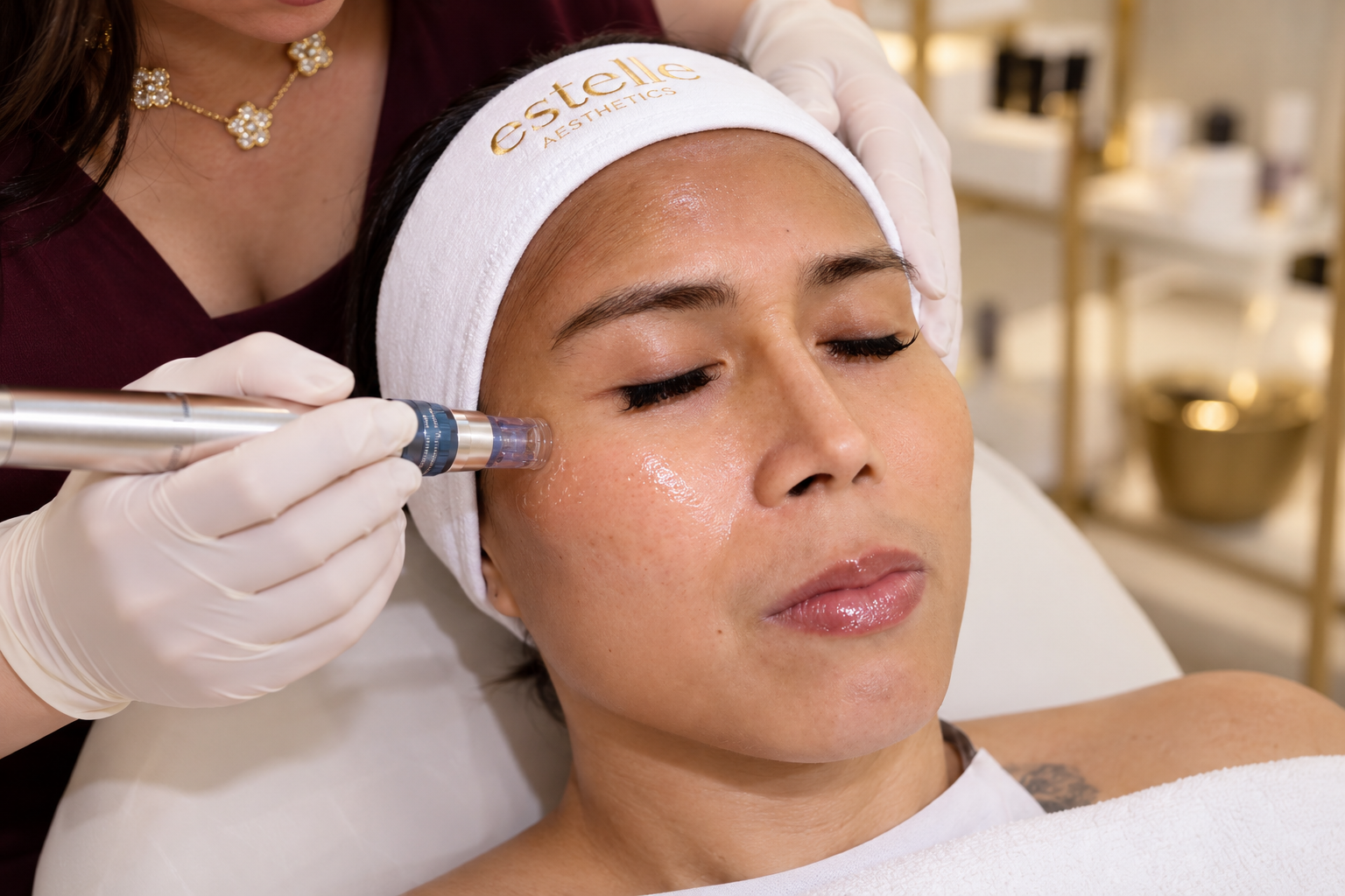 What Microneedling Actually Looks Like: Yani’s Treatment at Estelle